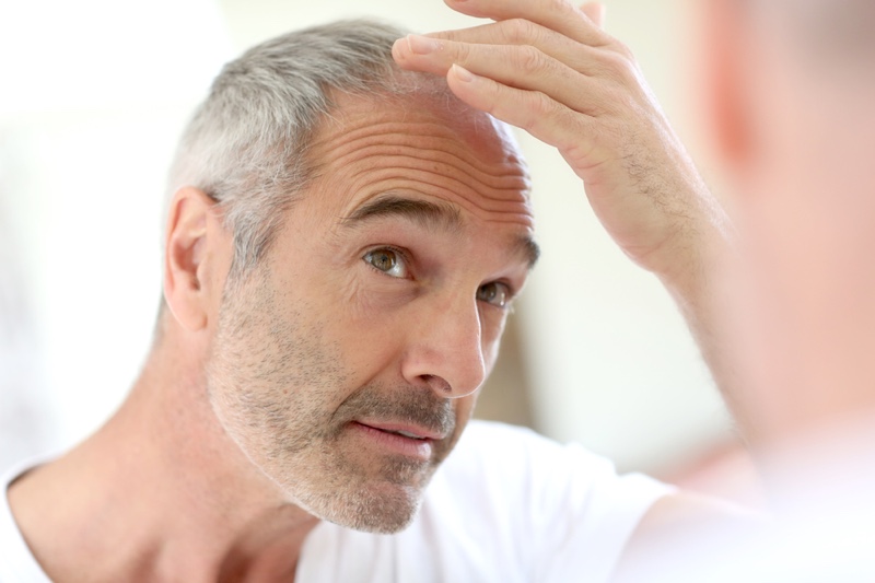 Hair loss in men