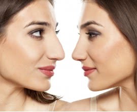 Plastic Surgery and Reconstructive surgery