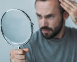 Hair Loss in Men