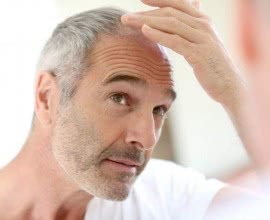 The Origin and Progress of Hair Loss Treatment