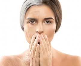 Facial aging