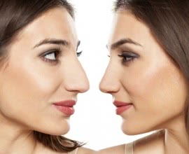 Wie die Nase eines Mannes, …