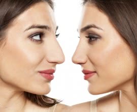 Plastische Chirurgie Weltweit